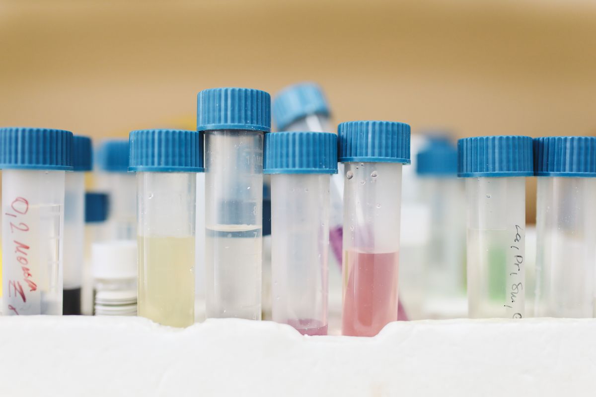 Labelled sample tubes with blue caps lined up in a laboratory, the kind of samples behind a certified water analysis report