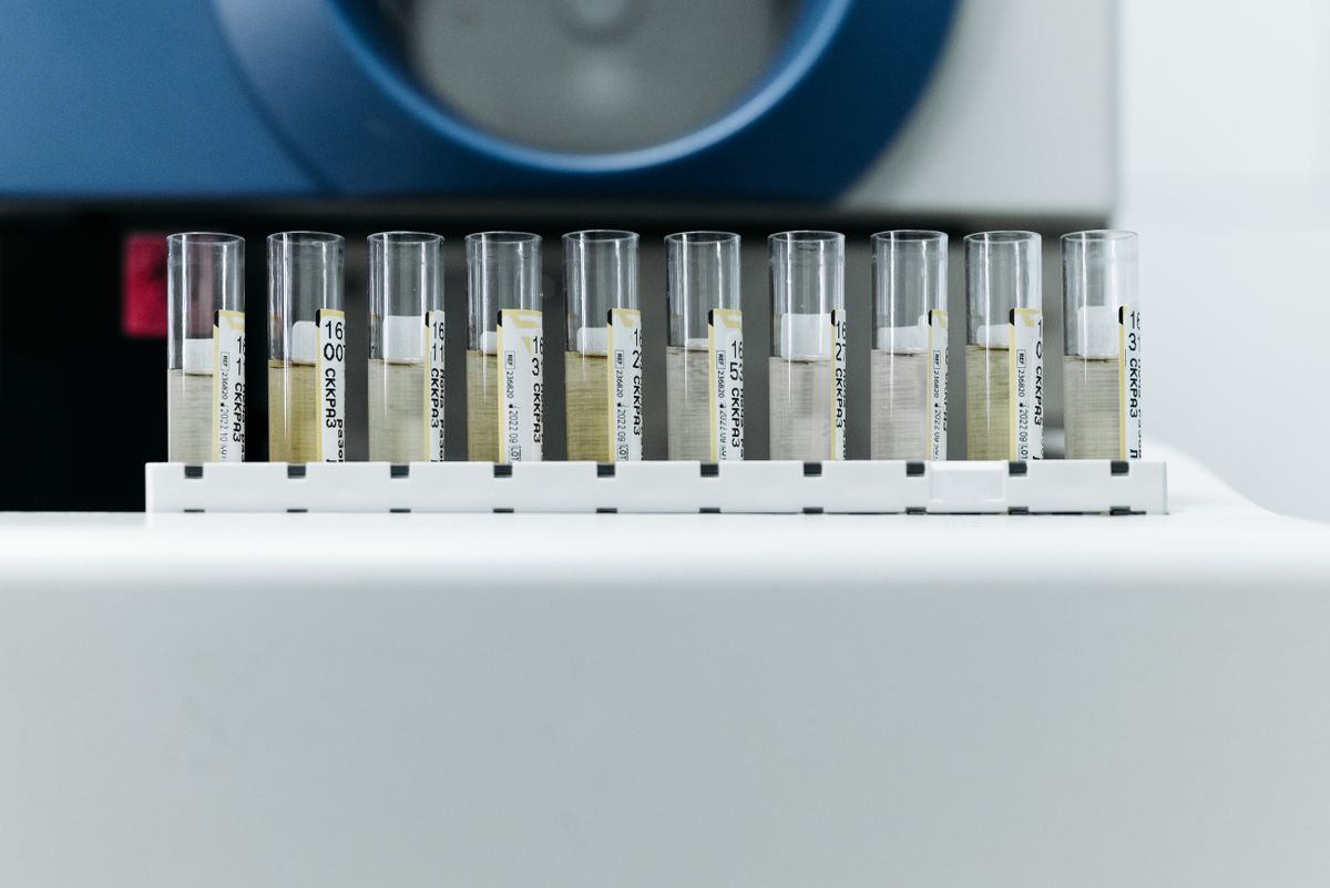 Laboratory test tubes holding water samples, representing certified hardness testing